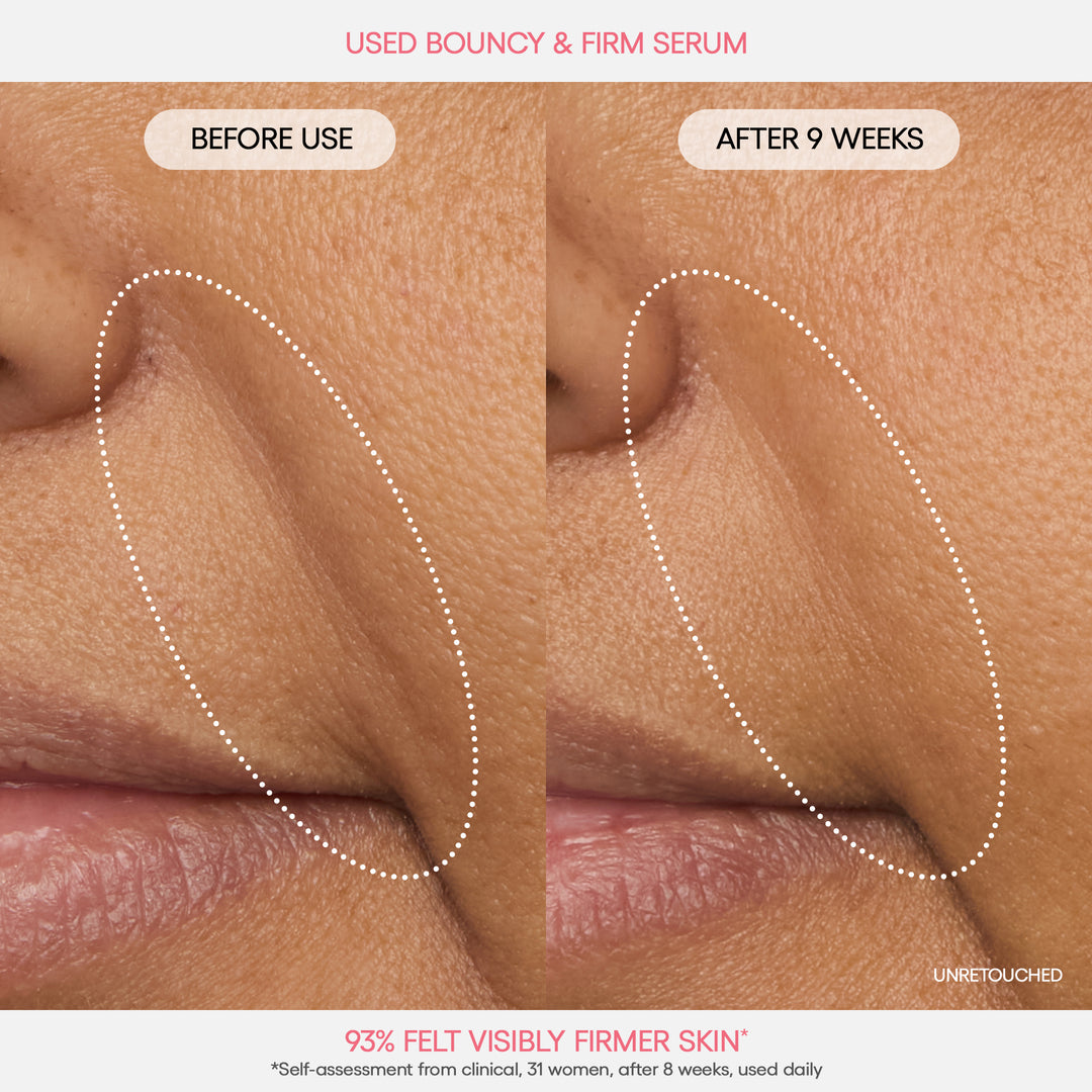 Bouncy Skin On The Go