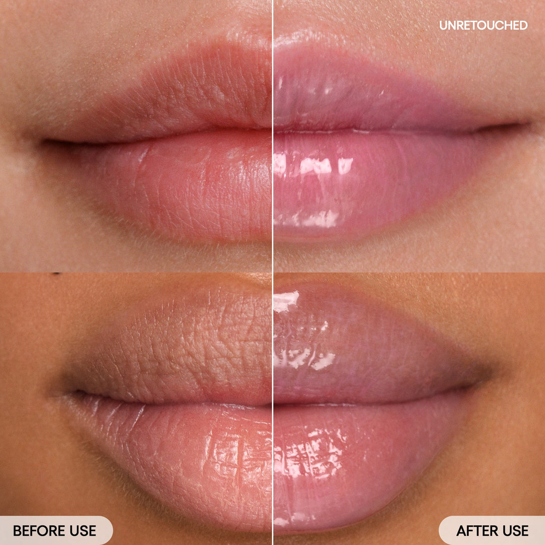 before & after Gummy Bear (Lavender tint) on model
