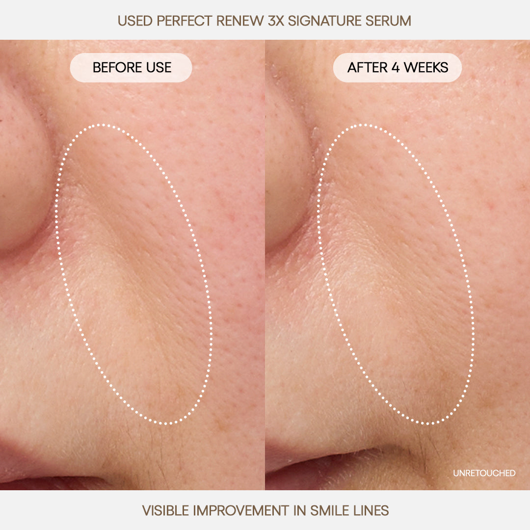 Perfect Renew 3X Signature Serum | Anti-Aging Serum for Wrinkles