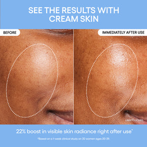 Cream Skin Toner & Moisturizer Before and After Results