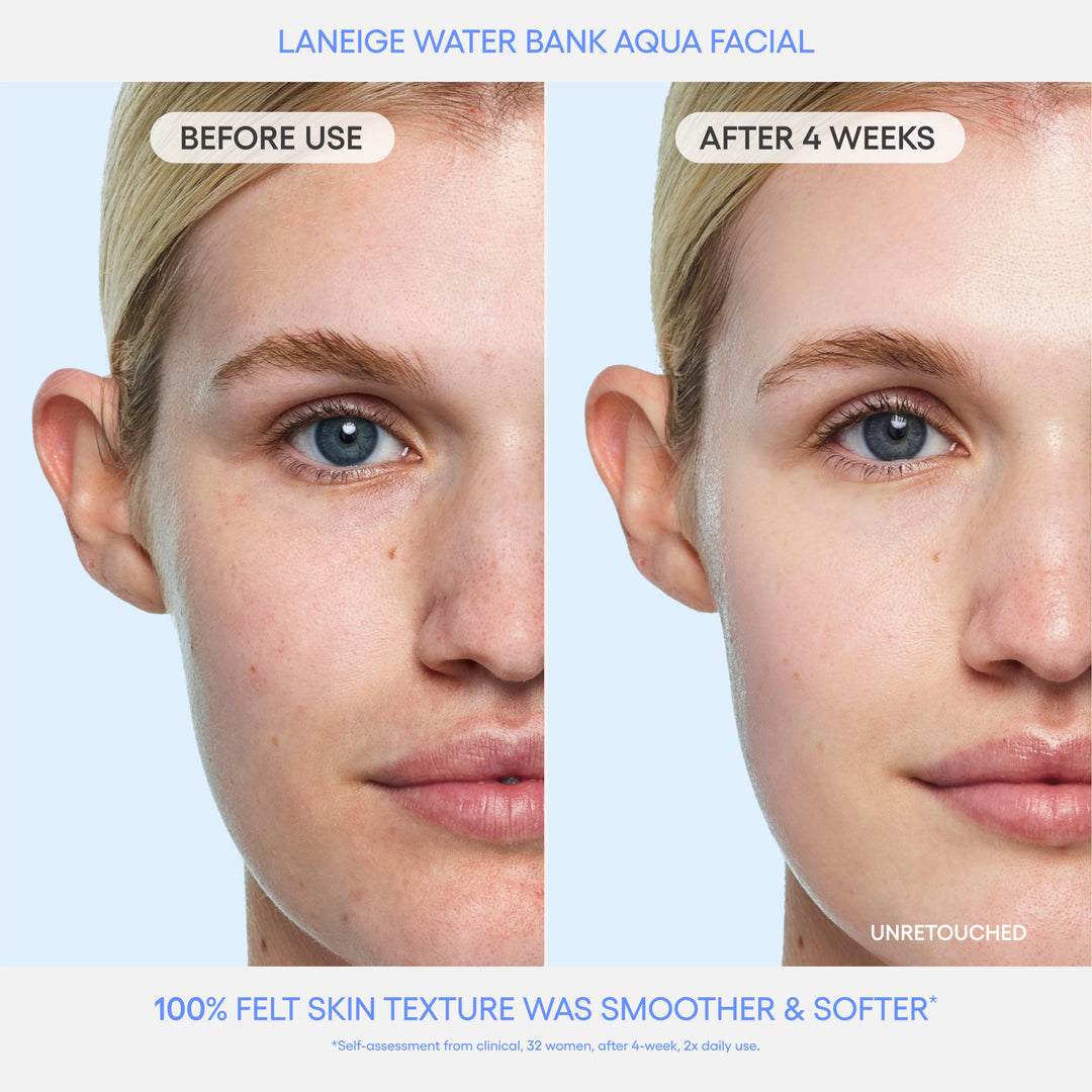 Water Bank Aqua Facial Before & After