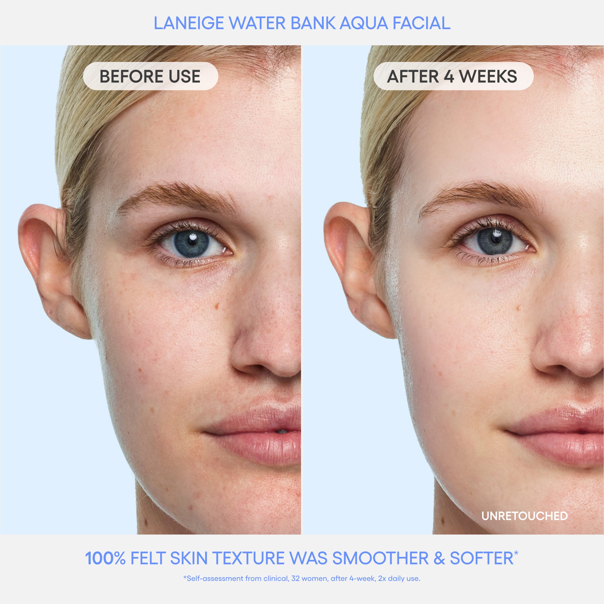 Water Bank Aqua Facial Before & After
