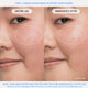 Enlarge image of Water Bank Blue Hyaluronic Intensive Moisturizer results